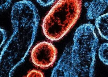 Imagem microscópica do vírus Nipah destacando partículas virais em células humanas