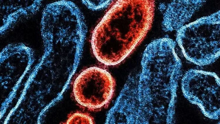 Imagem microscópica do vírus Nipah destacando partículas virais em células humanas